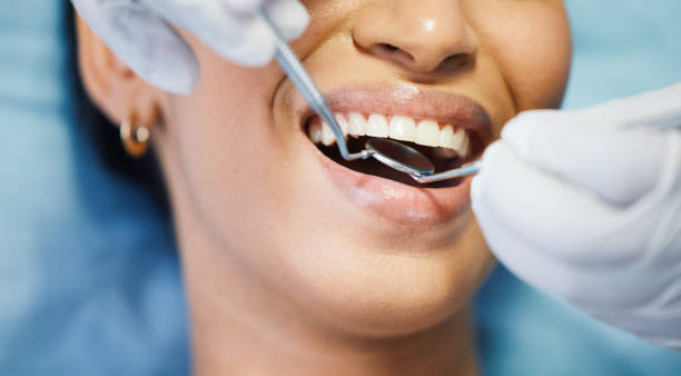 Best Emergency Dental Extractions in Wright, WY