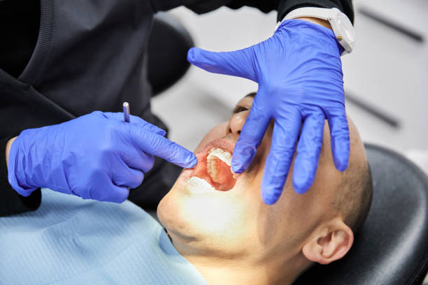 Best Emergency Dentist for Lost Fillings or Crowns in Wright, WY