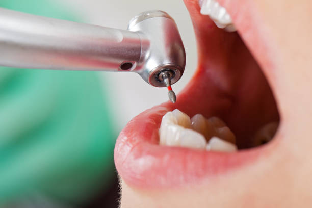 Best Weekend Emergency Dentist in Wright, WY
